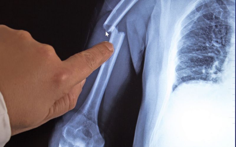 Falling Cargo Accidents: What You Need to Know and How an Attorney Can Help