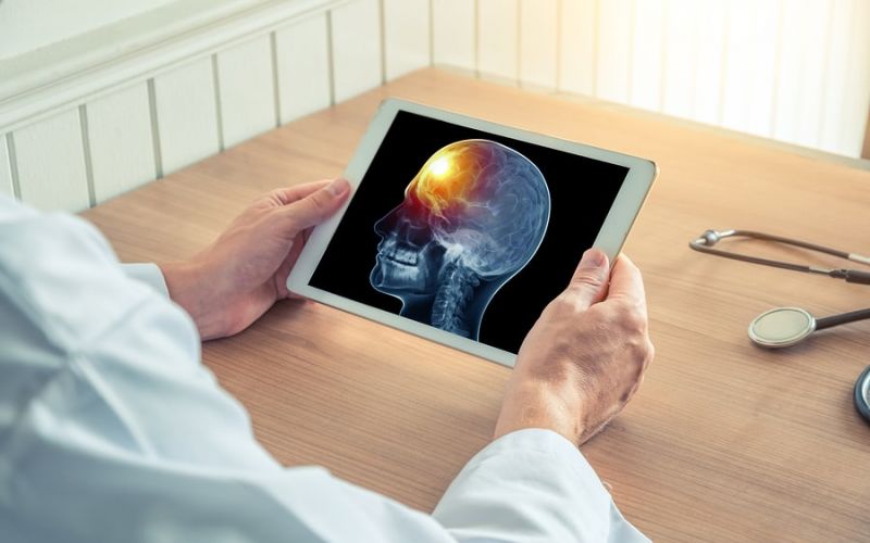 What Does a Traumatic Brain Injury Diagnosis Do for My Legal Claim
