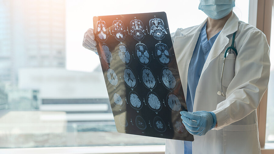 Brain Injury Attorneys