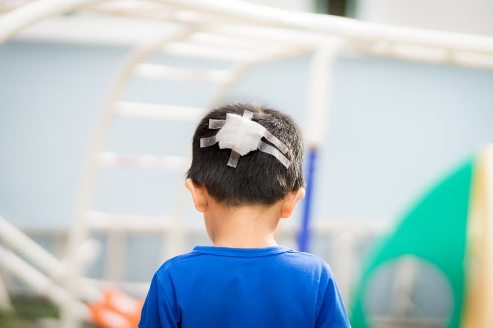 What are the Most Common Types of Child Injuries? - Boohoff Law P.A.